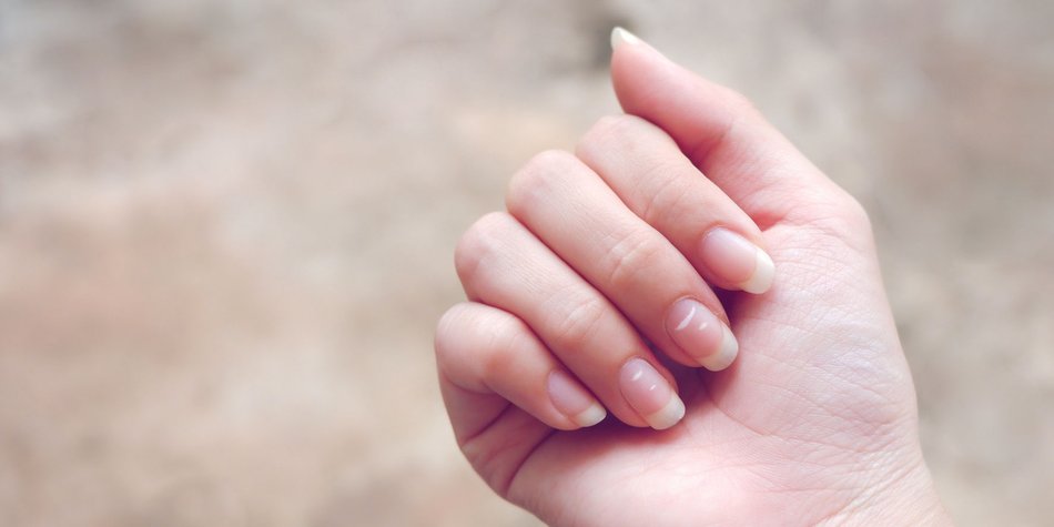 Krankheiten an den Fingernägeln erkennen: Diese 10 Zeichen solltest du beachten Krankheiten an den Fingernägeln erkennen: Diese 10 Zeichen solltest du beachten