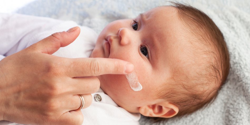 Hautpflege beim Baby: Die besten Tipps, um Allergien vorzubeugen Hautpflege beim Baby: Die besten Tipps, um Allergien vorzubeugen