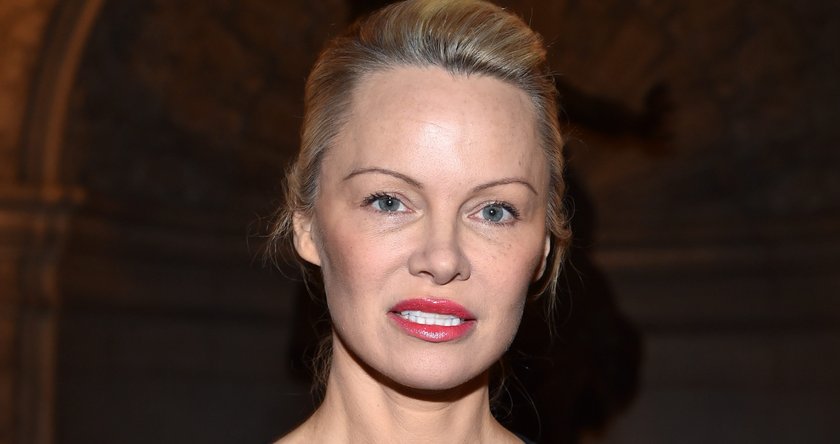 Botox-Fails der Stars: Pamela Anderson