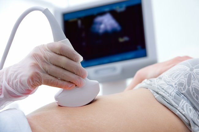 Anenzephalie erkennen am Ultraschall