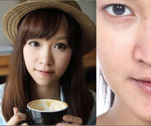 Lip Reduction: Der neue Beautytrend aus Asien?
