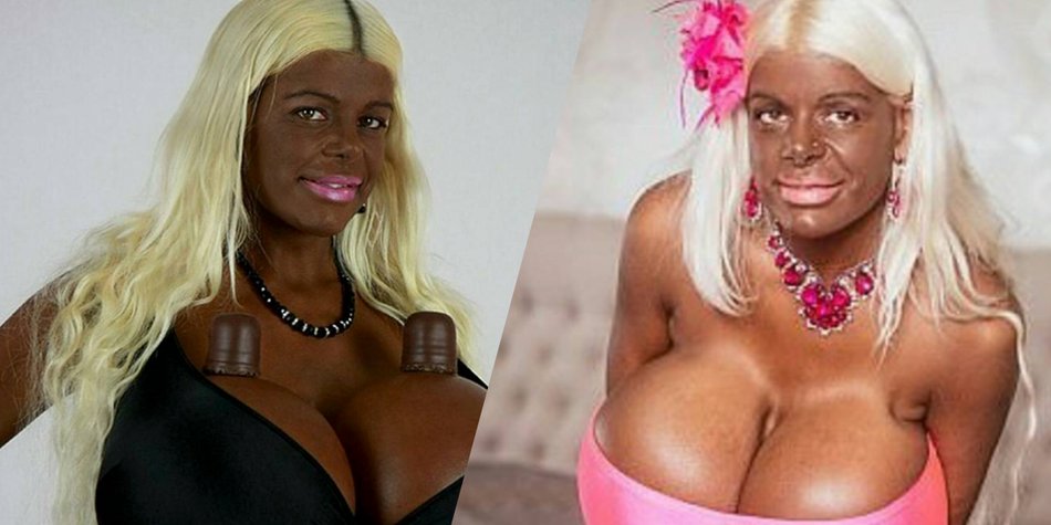 Riesen-Brüste: Martina Big hat sie schon wieder aufgepumpt! Riesen-Brüste: Martina Big hat sie schon wieder aufgepumpt!