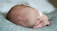Baby schwitzt am Kopf: Das kannst du tun