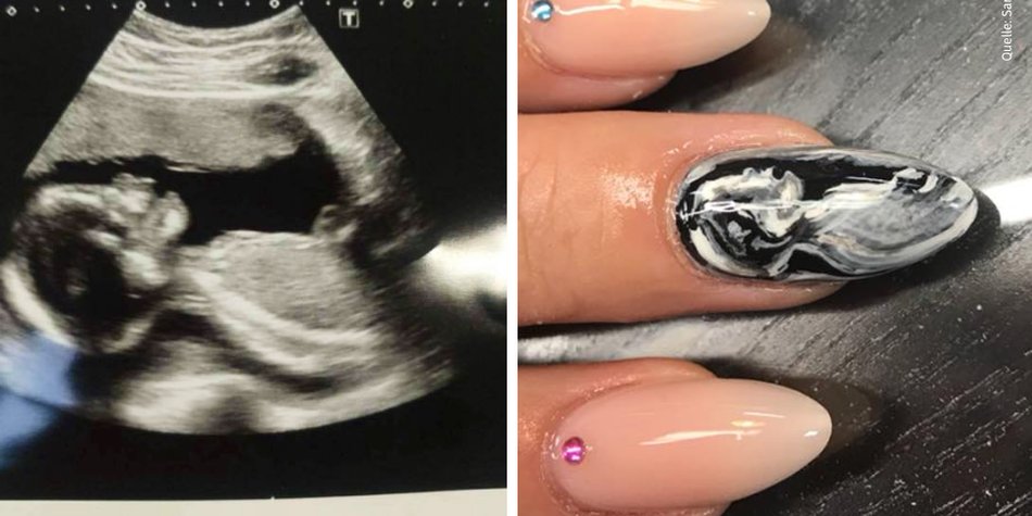 Ultrasound-Nails: Der süßeste Maniküre-Trend für Mamis Ultrasound-Nails: Der süßeste Maniküre-Trend für Mamis