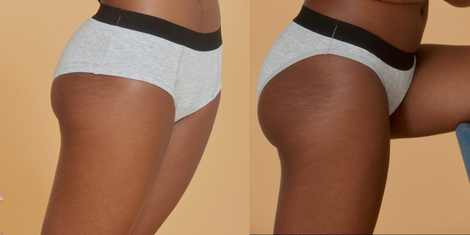 Machen Slips von Thinx Tampons und Binden überflüssig? Machen Slips von Thinx Tampons und Binden überflüssig?