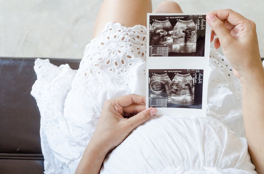 Schwangere Frau hält Ultraschallbilder in der Hand