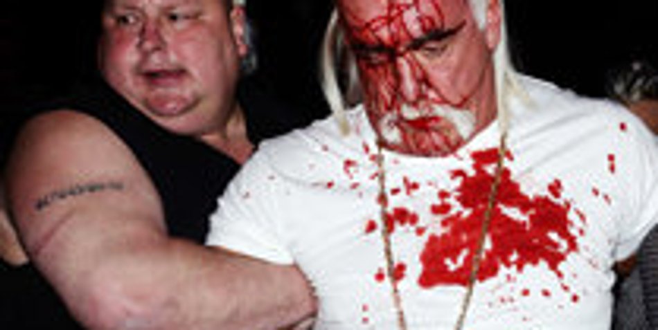Hulk Hogan wurde blutig geschlagen Hulk Hogan wurde blutig geschlagen