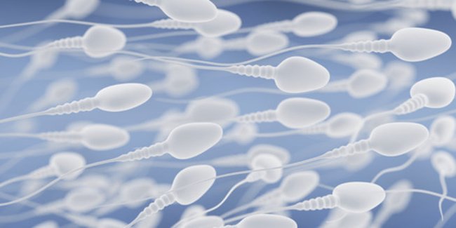 Spermiogramm: Ein Rudel Spermien