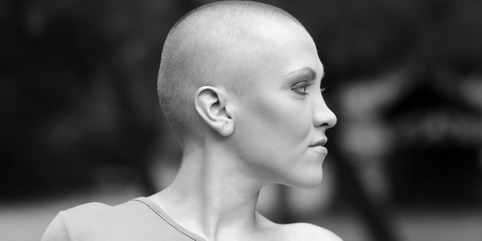 Die #BaldandBadChallenge bekämpft Vorurteile Die #BaldandBadChallenge bekämpft Vorurteile
