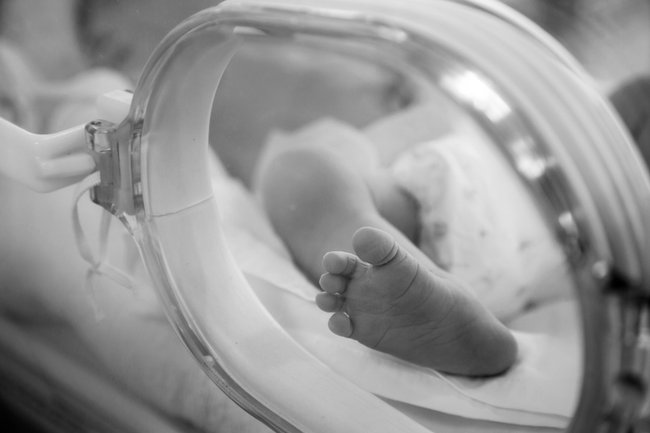 Säugling nach Geburt Anenzephalie