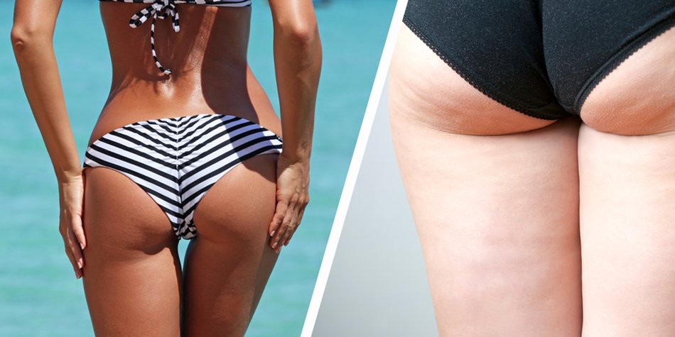 Wie kommt Cellulite auf dem Magazin-Cover an? Wie kommt Cellulite auf dem Magazin-Cover an?