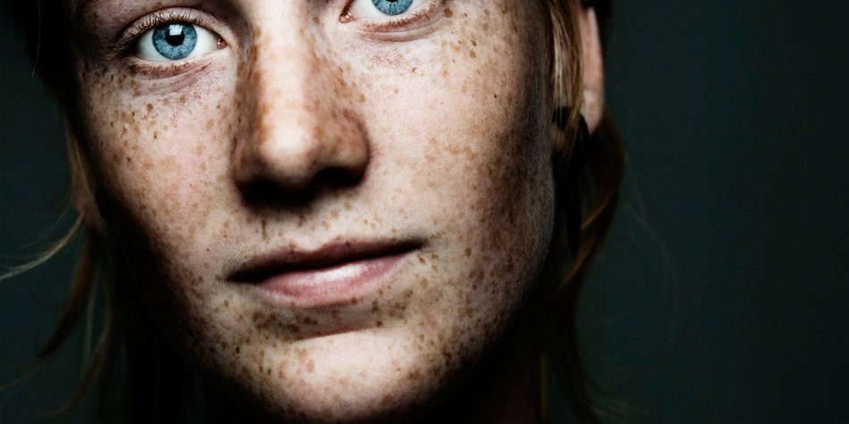 Sommersprossen-Tattoo: Ewige Flecken im Gesicht Sommersprossen-Tattoo: Ewige Flecken im Gesicht