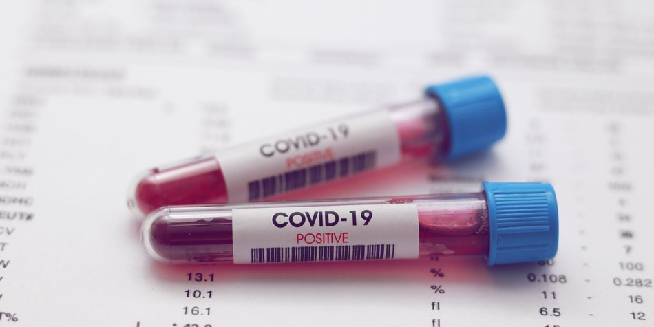 Corona-Immunität: Patient in Hongkong offenbar zum zweiten Mal infiziert Corona-Immunität: Patient in Hongkong offenbar zum zweiten Mal infiziert