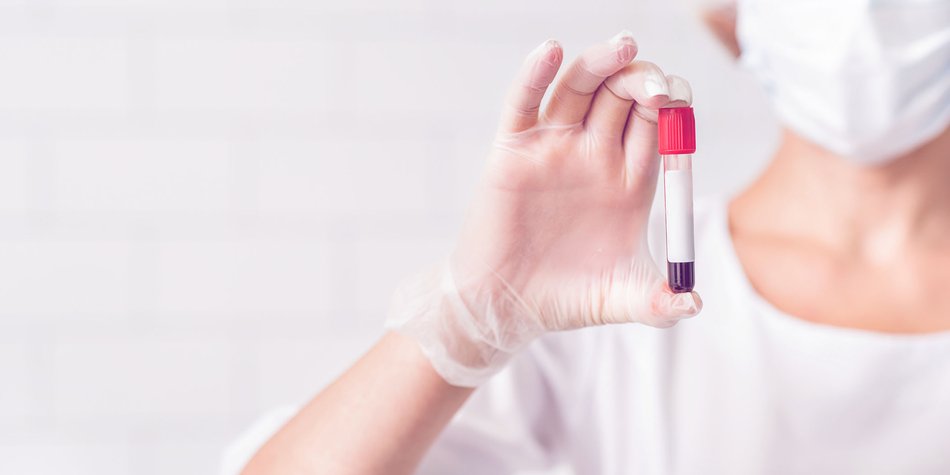 COVID-19 Antikörpertest: So kannst du dich selbst zu Hause testen COVID-19 Antikörpertest: So kannst du dich selbst zu Hause testen