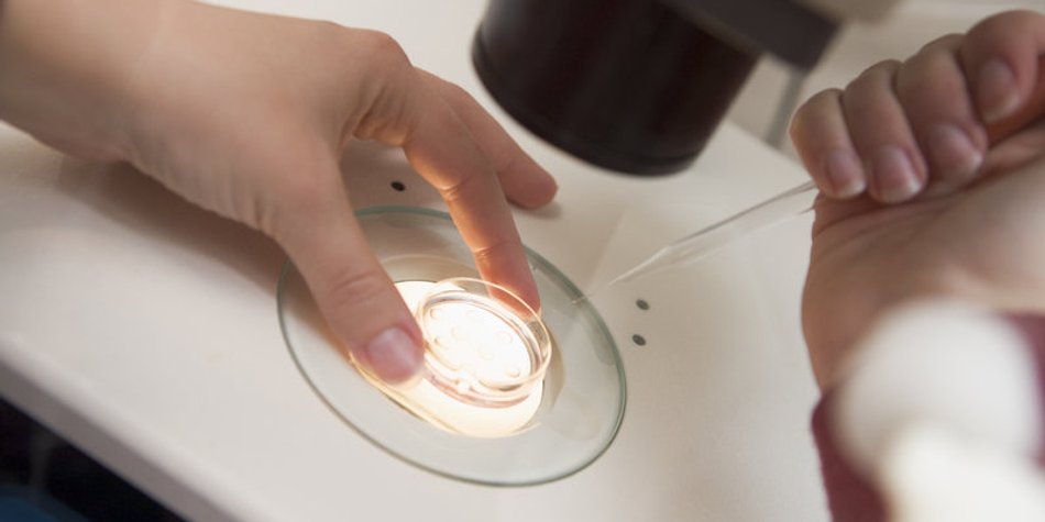 Künstliche Befruchtung durch In-Vitro-Fertilisation Künstliche Befruchtung durch In-Vitro-Fertilisation