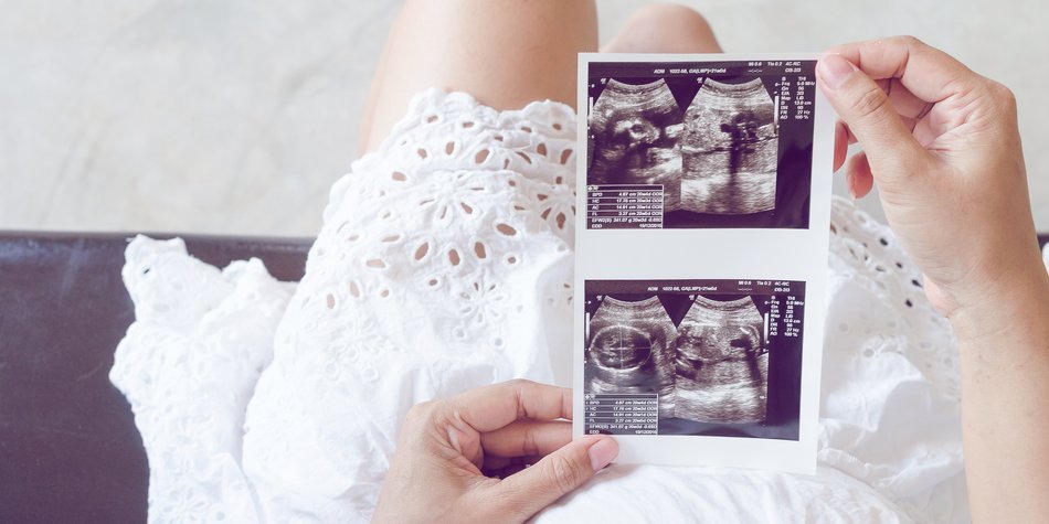 10. SSW: Das Herz des Babys schlägt immer stärker 10. SSW: Das Herz des Babys schlägt immer stärker