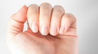 Krankheiten an den Fingernägeln erkennen: Beachte diese 10 Zeichen!