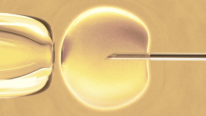 IVF - In Vitro Fertilisation