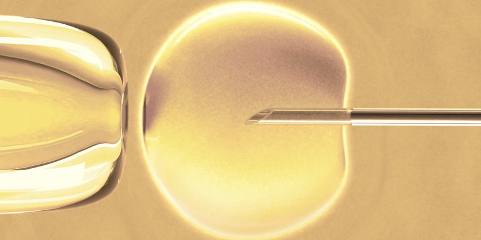 IVF: In-vitro-Fertilisation IVF: In-vitro-Fertilisation