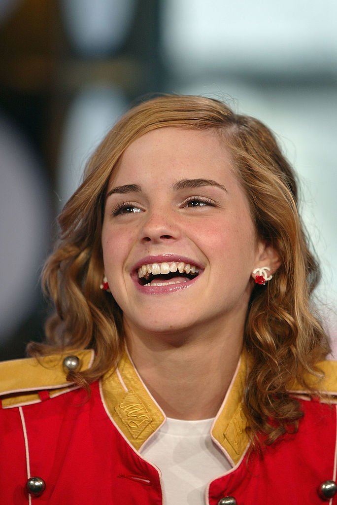 Emma Watson gemachte Zähne