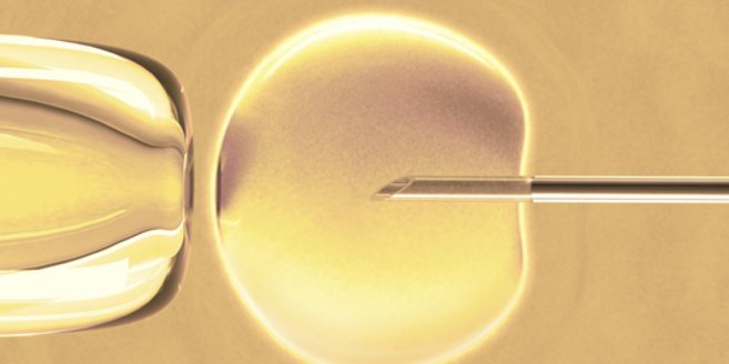 Eine IVF Eine IVF