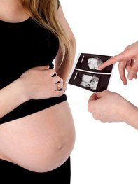 Auf den Ultraschallbildern ist ab dem zweiten Trimester das Gesicht erkennbar. Auf den Ultraschallbildern ist ab dem zweiten Trimester das Gesicht erkennbar.