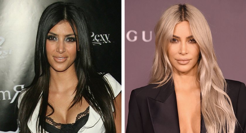 Kim Kardashian vorher nachher