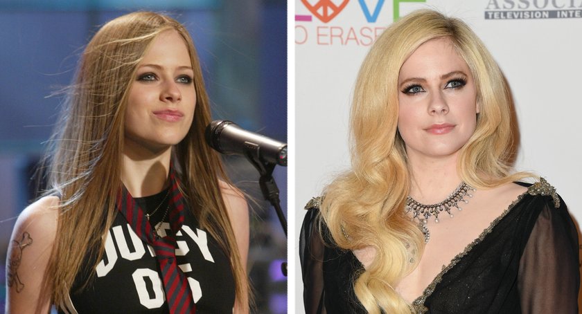Avril Lavigne vorher nachher