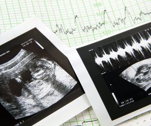 Eine Frau fotografiert ihre Abtreibung