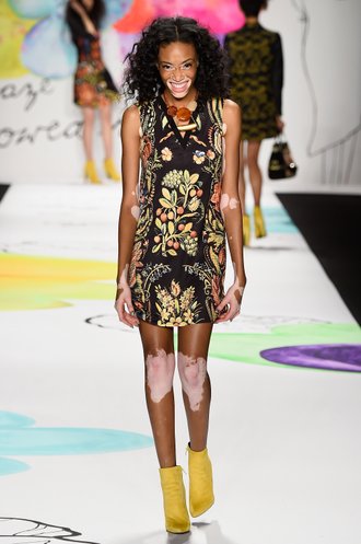 Winnie Harlow Winnie Harlow