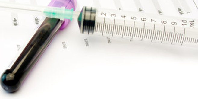 Der Bluttest auf Down-Syndrom wird nun auch in Deutschland angeboten Der Bluttest auf Down-Syndrom wird nun auch in Deutschland angeboten