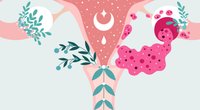 Eierstockzyste: Symptome, die für eine Ovarialzyste sprechen