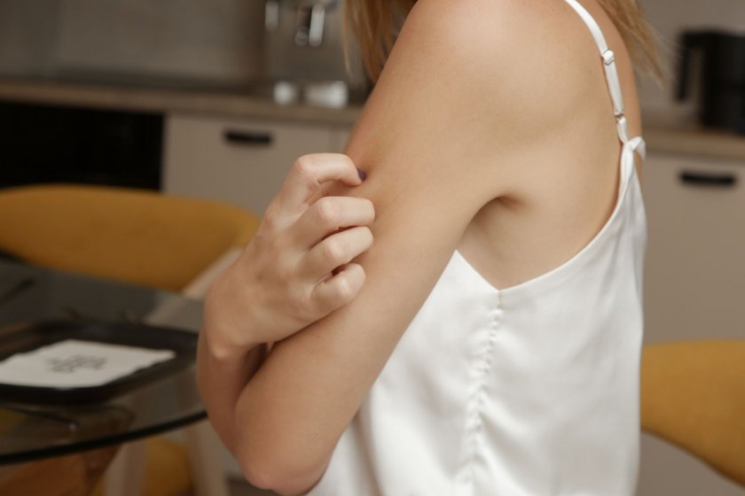 Frau, die sich am Arm kratzt