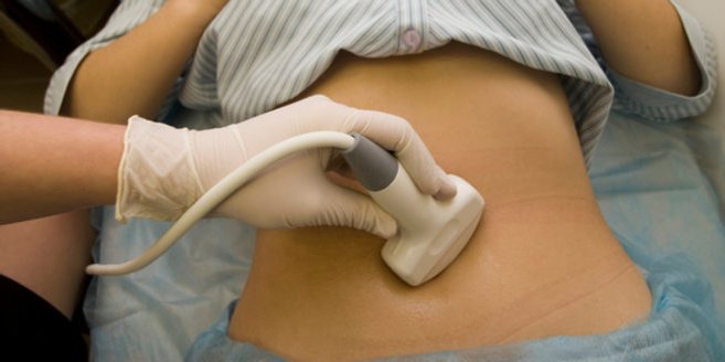 Sterilitätsdiagnostik: Ultraschalluntersuchug bei einer Frau Sterilitätsdiagnostik: Ultraschalluntersuchug bei einer Frau