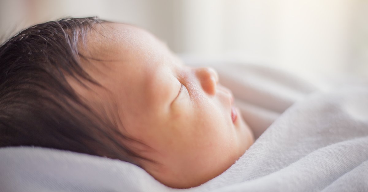 Gelbsucht bei Baby & Neugeborenen: Ursache, Symptome, Behandlung