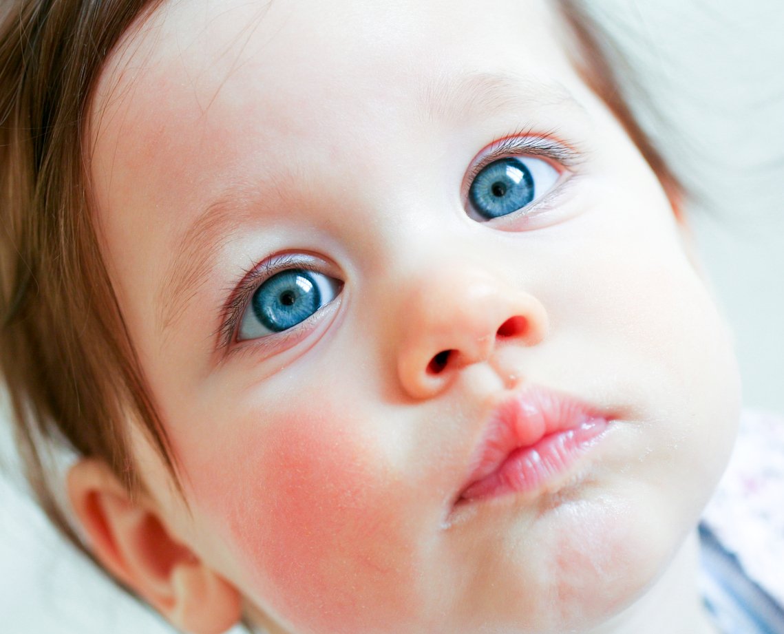 Rote Wangen Baby Rote Wangen Baby