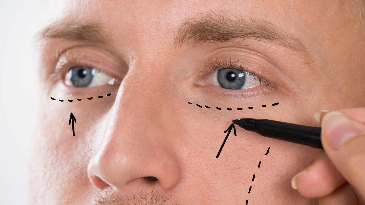 Close-up Of Person's Hand Drawing Correction Line With Pen Near Man's Eyes