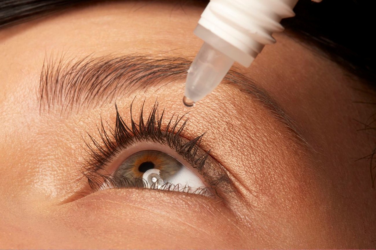 Pickel im Auge mit Augentropfen behandeln Pickel im Auge mit Augentropfen behandeln