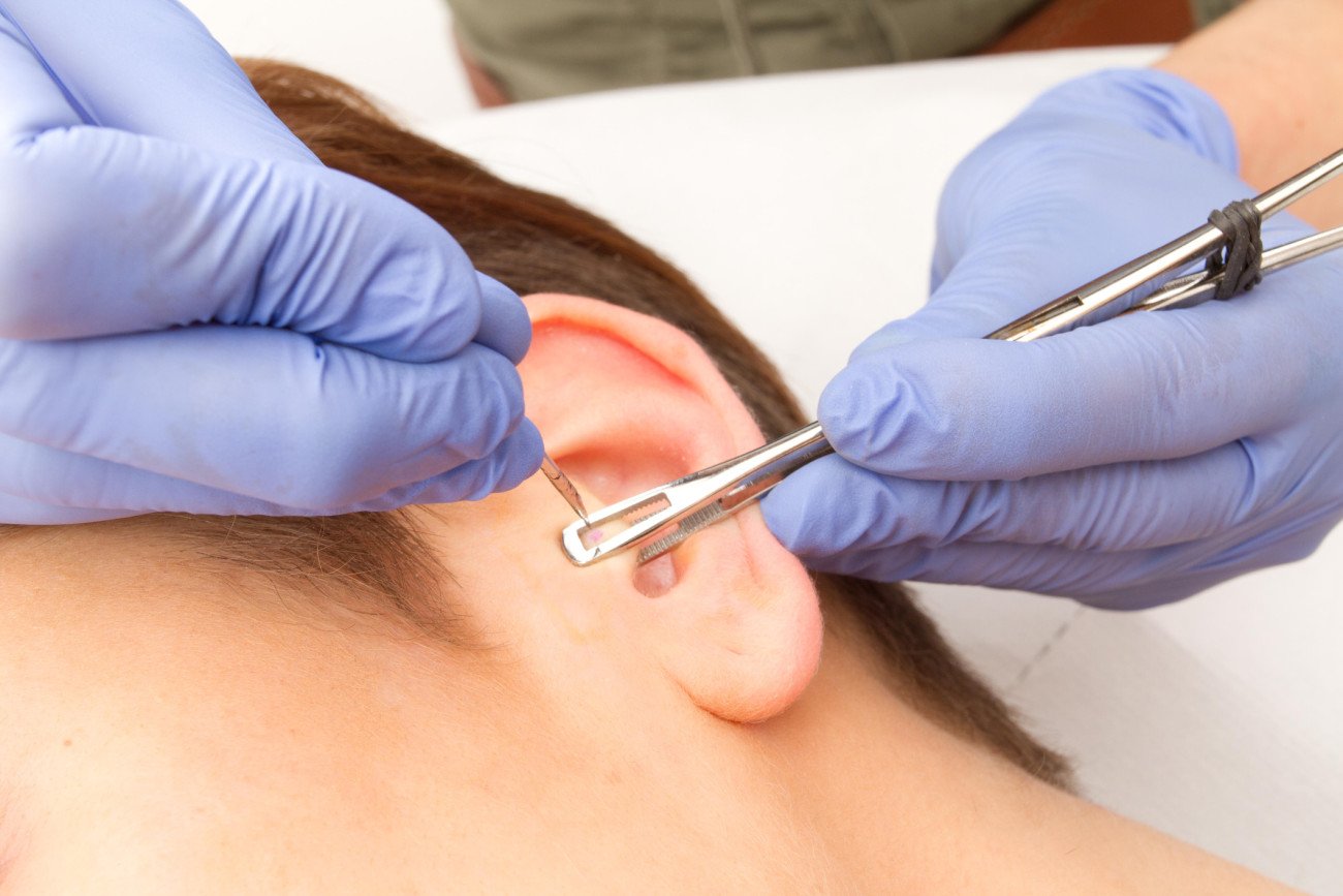 Piercing entzündet Piercing entzündet