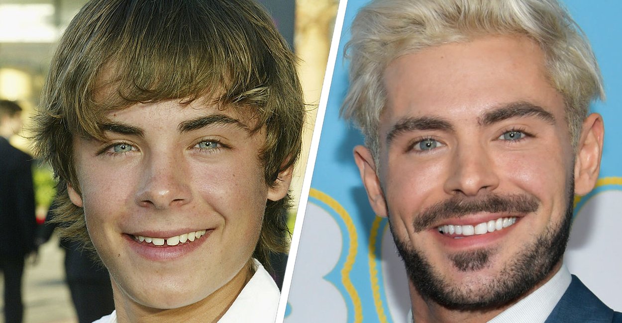 Diese 19 Stars Haben Gemachte Zähne Desiredde