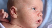 Neugeborenenakne: Wie lange sie dauert und was du dagegen tun kannst