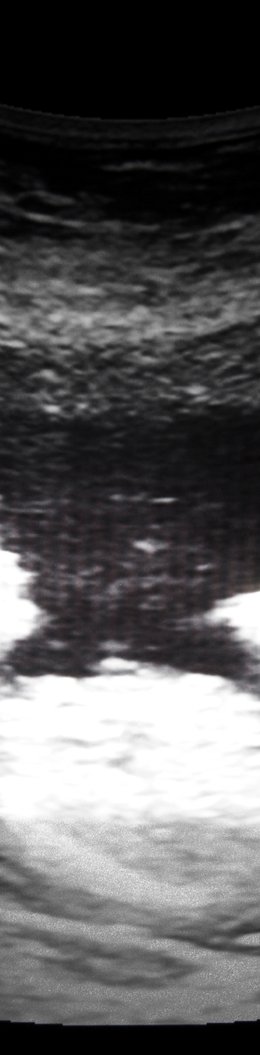 Baby in der 38. SSW Baby in der 38. SSW