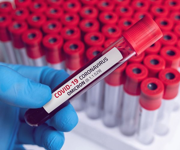 Extrem ansteckend: So gefährlich ist die Corona-Mutation XBB.1.5 wirklich
