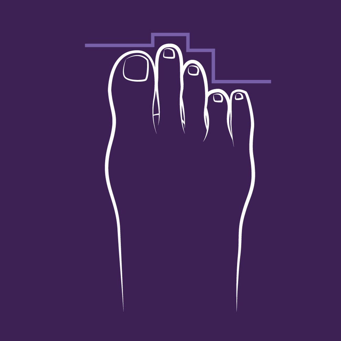 Fußform: Alle 5 Arten und ihre Bedeutung im Überblick