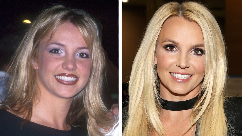Britney Spears vorher nachher