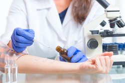Allergietest bei photoallergischen Reaktionen Allergietest bei photoallergischen Reaktionen