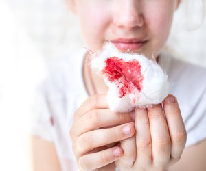 Nasenbluten bei Kindern: Das solltest du jetzt unbedingt tun!