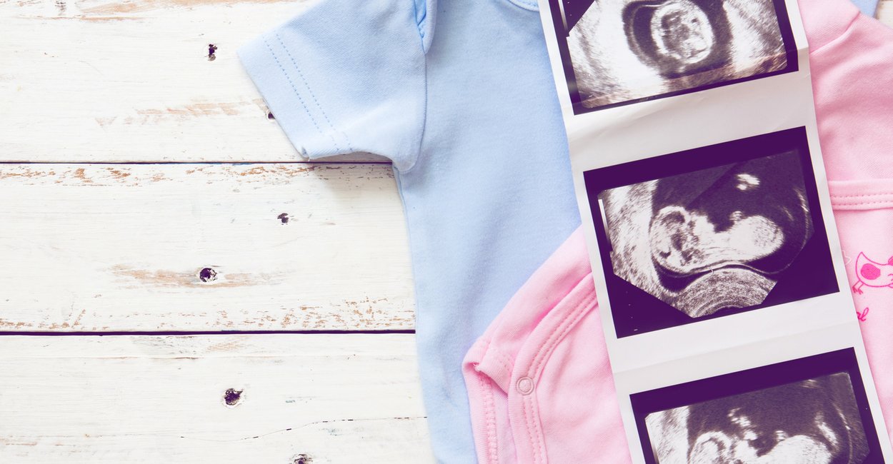 Ultraschallbilder Bis Zur 40 Ssw So Entwickelt Sich Ein Baby