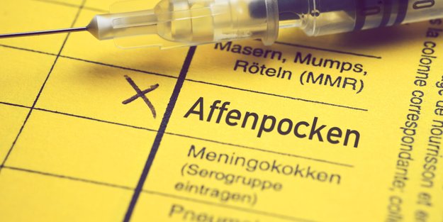 Affenpocken: Karl Lauterbach bestellt 40.000 Dosen Impfstoff