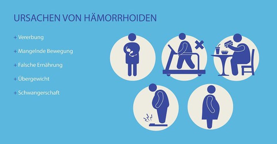 Hämorrhoiden In Der Schwangerschaft Behandeln www.desired.de